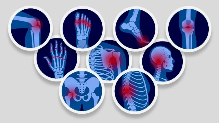 Pain Management Doctor