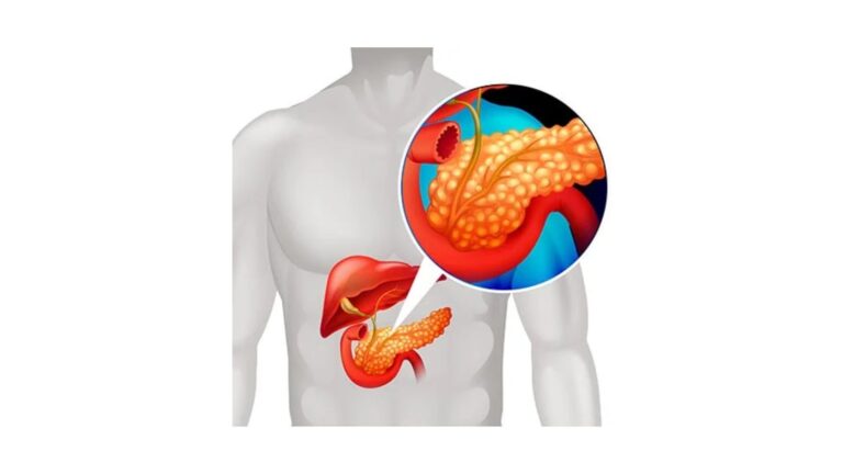 Biliary Tract Diseases dr rakesh kumawat vascular and interventional radiologist