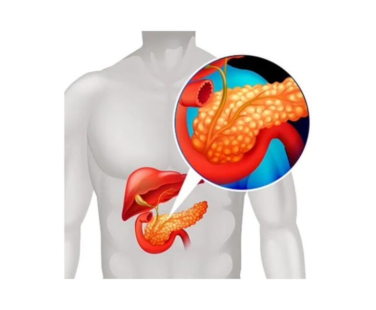 Biliary Tract Diseases dr rakesh kumawat vascular and interventional radiologist