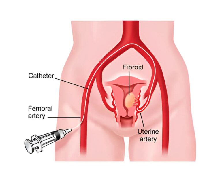 Obs & Gynaecologist UAE dr rakesh kumawat vascular and interventional radiologist