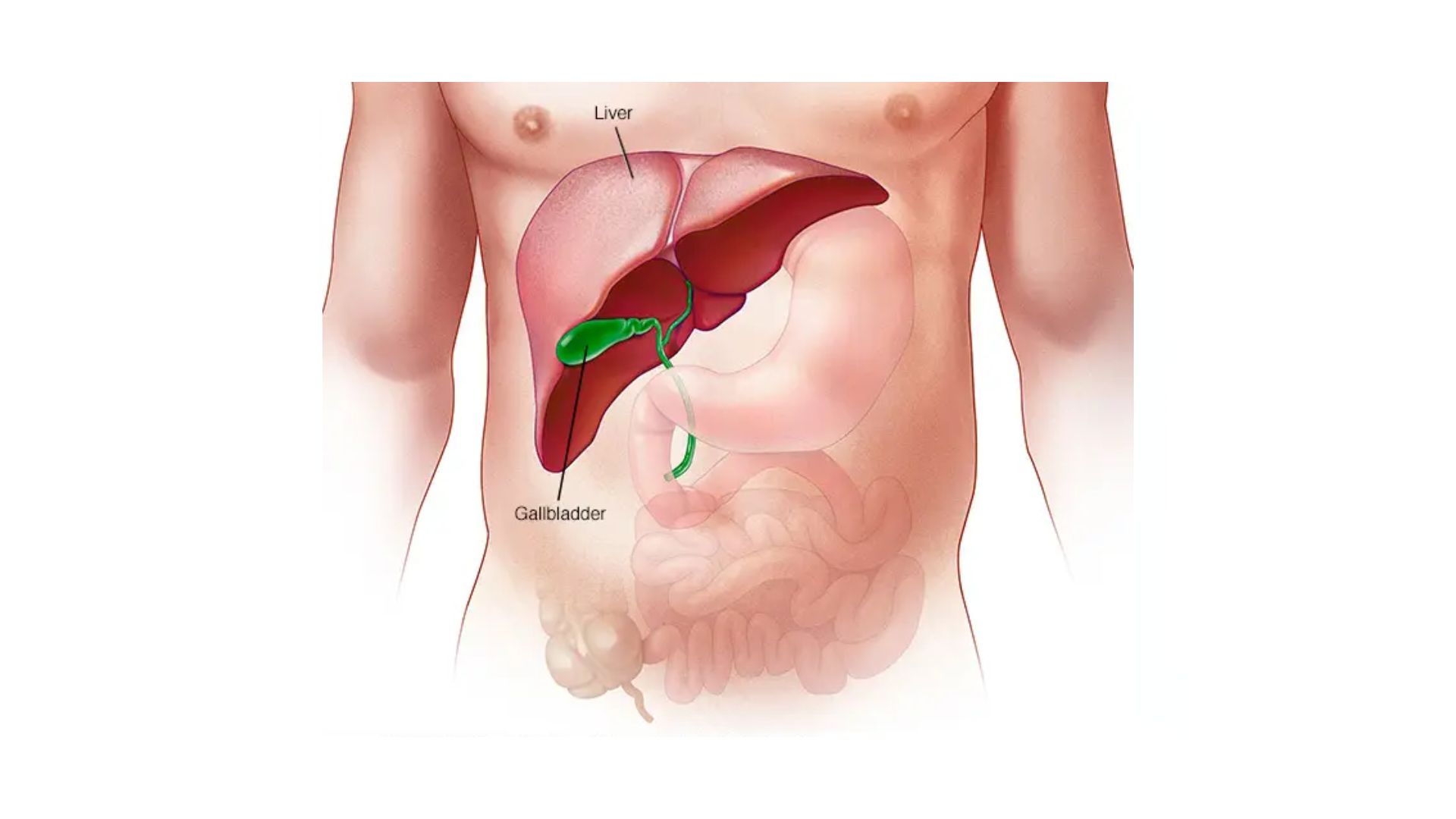 vascular artery Liver Cirrhosis and PHT dr rakesh kumawat vascular and interventional radiologist